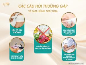 Giải đáp các câu hỏi thường gặp về giá làm hồng nhũ hoa tại Rio Beauty Clinic.