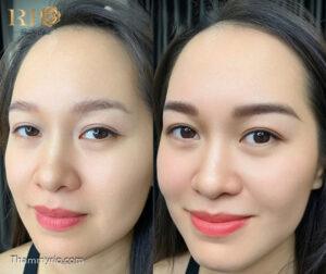 Trong khi các phương pháp Hairstroke thông thường chỉ duy trì màu sắc đẹp trong khoảng 2 năm, công nghệ Hairstroke Glamor Brow tại Thẩm Mỹ Rio đảm bảo giữ màu bền bỉ lên đến 5 năm, không bị trổ đỏ hay phai màu theo thời gian.