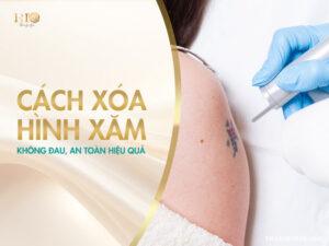 Hãy cùng khám phá các cách xóa hình xăm vĩnh viễn để loại bỏ những dấu mực không mong muốn một cách thông minh nhất.