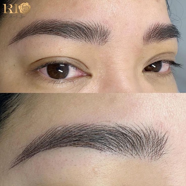 Điêu khắc Hairstroke không đau, không sưng