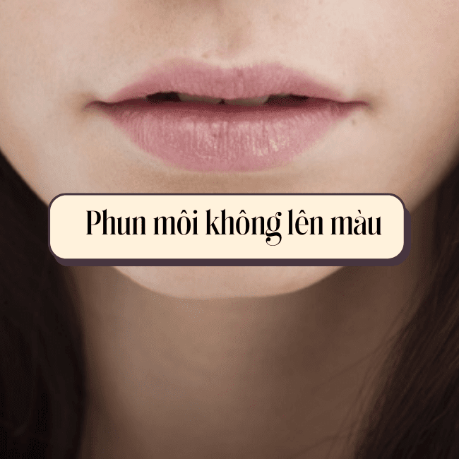 Lý do phun môi không lên màu và giải pháp tại Thẩm mỹ Rio