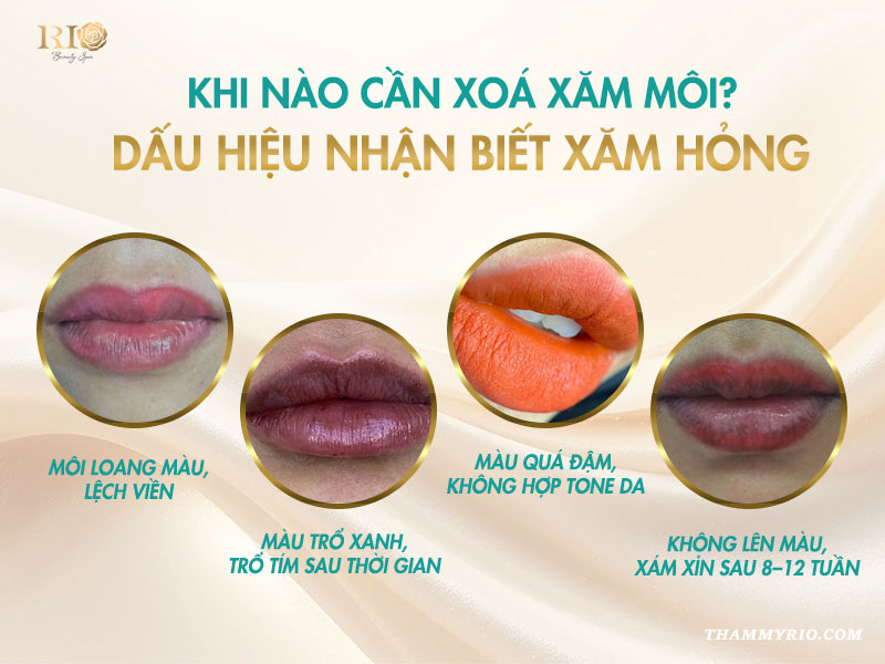 Xăm môi xong có xóa được không? 5 giải pháp hiệu quả nhất 3 Dấu hiệu nhận biết và xử lý khi xăm môi hỏng có xoá được không?