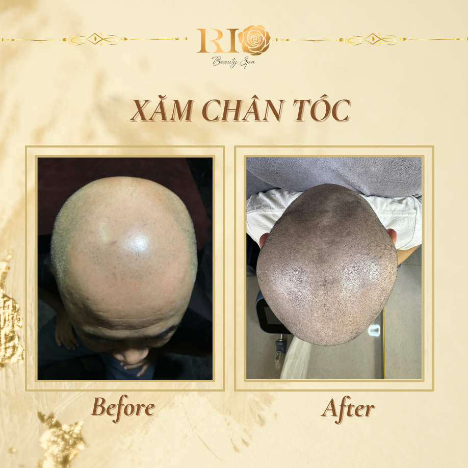 Home 28 dich-vu-xam-cham-toc-thammyrio.com