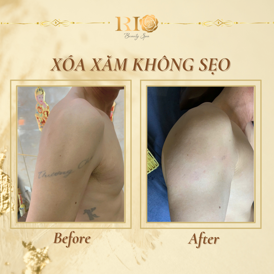 Home 23 dich vu xoa xam khong seo thammyrio.com