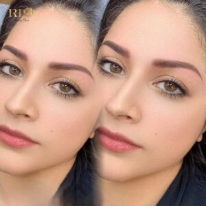 Quá trình phục hồi sau phun xăm mày tại Thẩm Mỹ Rio Beauty Clinic