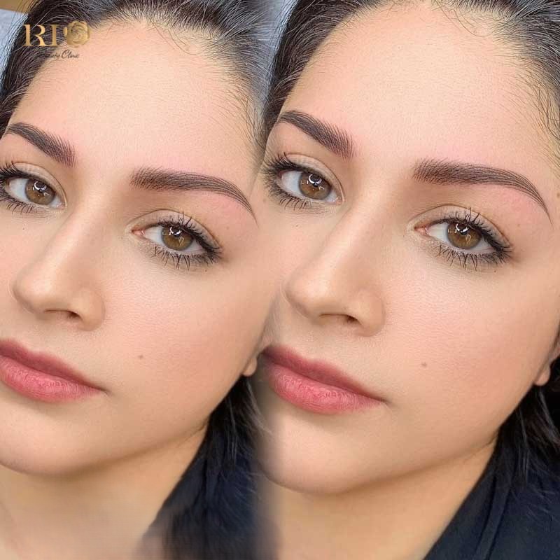 Quá trình phục hồi sau phun xăm mày tại Thẩm Mỹ Rio Beauty Clinic