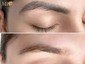 sửa dáng lông mày đã phun, sửa lông mày