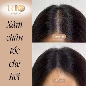 xam-chan-toc-che-hoi