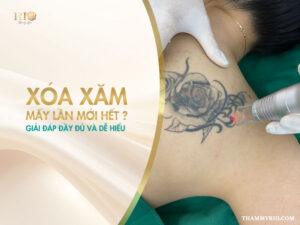 "Xóa xăm mấy lần thì hết? Là câu hỏi chung của rất nhiều người mong muốn tìm lại vẻ đẹp nguyên bản cho làn da của mình.