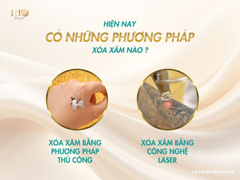 Xóa xăm mấy lần mới hết? Giải đáp đầy đủ và dễ hiểu 2 Để biết xóa xăm mấy lần mới hết, bạn cần hiểu rõ về các phương pháp đang được áp dụng. Mỗi cách có cơ chế, hiệu quả và số lần thực hiện khác nhau.