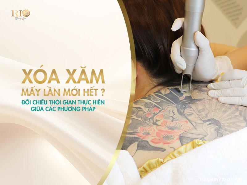 Xóa xăm mấy lần mới hết? Giải đáp đầy đủ và dễ hiểu 3 Xóa xăm mấy lần mới hết? Với những ai đang cân nhắc việc xóa hình xăm, đây là vấn đề được quan tâm hàng đầu.