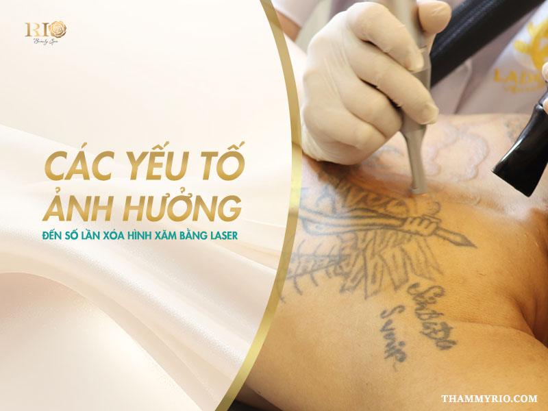 Xóa xăm mấy lần mới hết? Giải đáp đầy đủ và dễ hiểu 4 Không có một con số chung cho tất cả mọi người. Việc xóa xăm mấy lần mới hết phụ thuộc trực tiếp vào 4 yếu tố cốt lõi sau đây