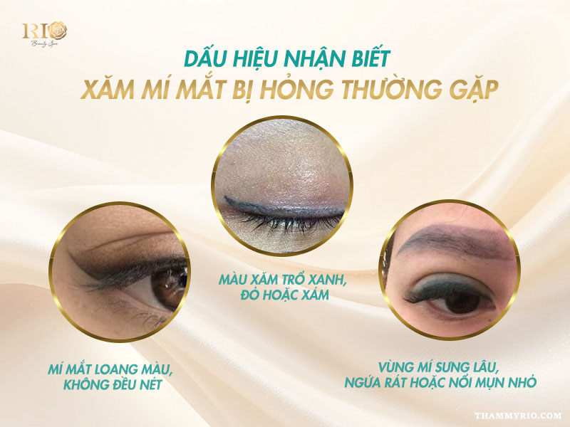 Xăm mí mắt bị hỏng phải làm sao? Giải pháp nào khắc phục 2 Hình ảnh minh họa các dấu hiệu xăm mí mắt bị hỏng như lệch viền, sưng đỏ và loang màu.