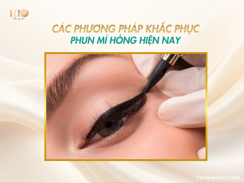 Xăm mí mắt bị hỏng phải làm sao? Giải pháp nào khắc phục 4 Hình ảnh minh họa quy trình khắc phục xăm mí mắt bị hỏng bằng công nghệ laser hiện đại.