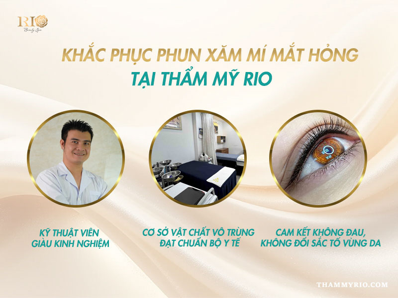 Xăm mí mắt bị hỏng phải làm sao? Giải pháp nào khắc phục 5 Chuyên gia Thẩm Mỹ Rio thực hiện khắc phục xăm mí mắt bị hỏng bằng công nghệ laser tiên tiến.