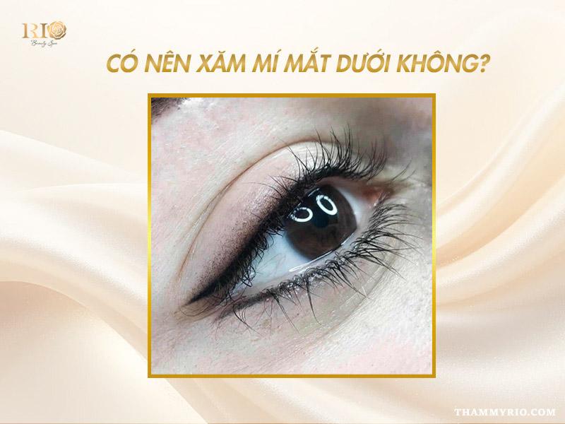 Xăm mí mắt dưới là gì? Bảng giá & hình ảnh mới nhất 2026 3 Có nên xăm mí mắt dưới không