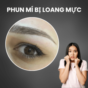 phun-mi-bi-loang-muc