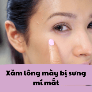 xam long may bi sung mi mat