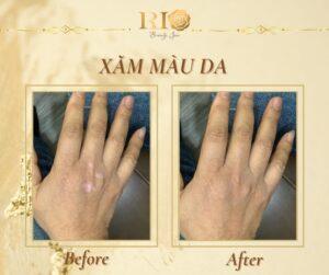 Ứng dụng của xăm màu da