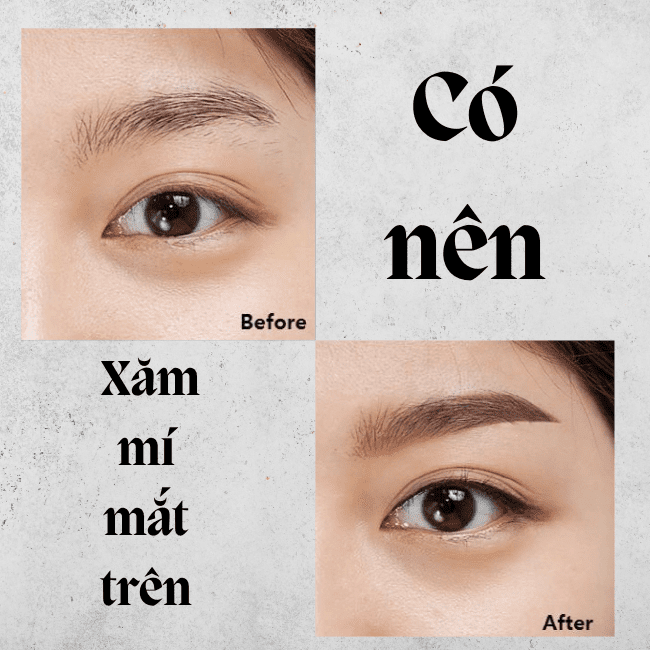 Có nên xăm mí mắt trên không?