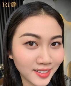 airstroke Glamor Brow là kỹ thuật điêu khắc lông mày tiên tiến do Thẩm Mỹ Rio Beauty Clinic sáng tạo và phát triển từ cuối năm 2024. Phương pháp này kết hợp tinh hoa nghệ thuật tạo sợi lông mày siêu thực, tái hiện từng sợi lông mày chân thật đến mức khi đứng cách 1 mét