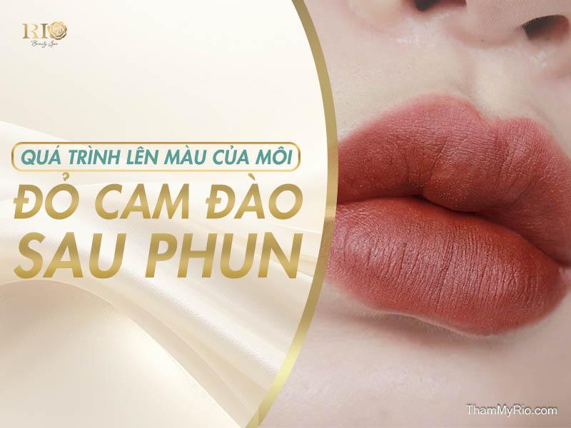 Phun Môi Màu Đỏ Cam Đào Công Nghệ Travylip Trẻ Thêm 10 Tuổi 8 Không chỉ là địa chỉ phun xăm thẩm mỹ lâu đời, Rio còn chỉn chu trong từng khâu đào tạo chuyên viên, lựa chọn thiết bị, mực xăm