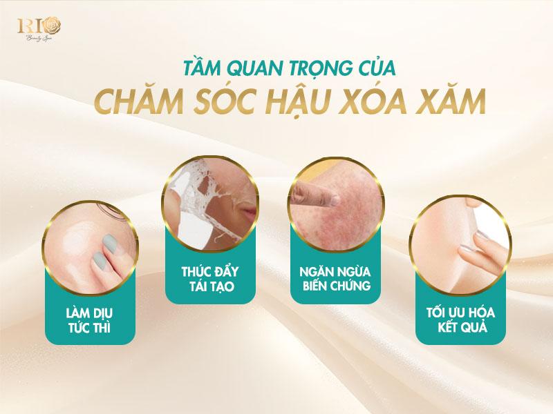 Melsmon Mira Tattoo Remover : Phục hồi da sau xóa xăm laser hoàn hảo 3 Quá trình xóa xăm laser đang ngày càng trở nên phổ biến nhờ hiệu quả vượt trội trong việc loại bỏ mực xăm. Tuy nhiên, sau mỗi liệu trình, làn da của bạn cần được chăm sóc đặc biệt để đảm bảo quá trình phục hồi diễn ra tốt nhất và đạt được kết quả thẩm mỹ tối ưu.