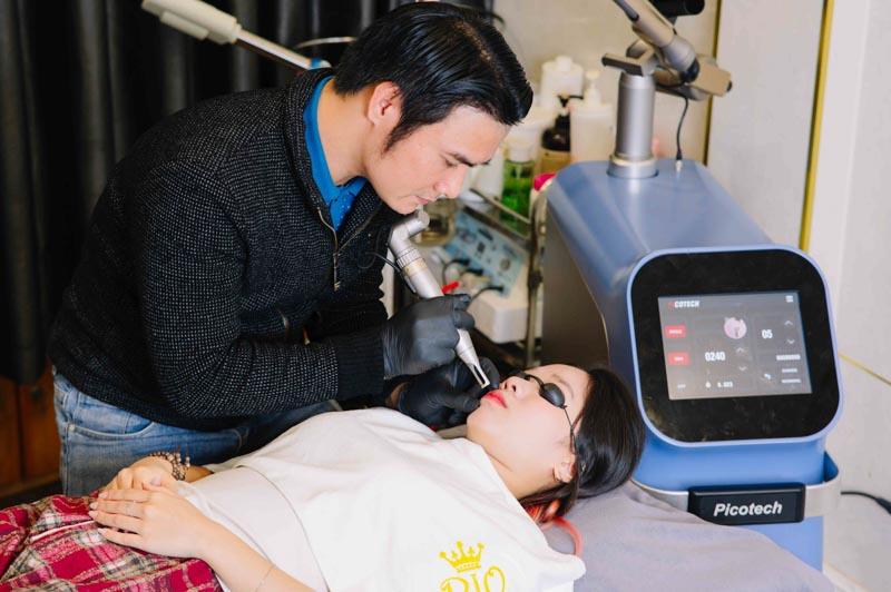 Melsmon Mira Tattoo Remover : Phục hồi da sau xóa xăm laser hoàn hảo 2 Bạn đang tìm kiếm giải pháp tối ưu để phục hồi làn da sau liệu trình xóa xăm laser?