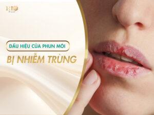 Sau khi phun môi, nếu môi không hồi phục bình thường mà xuất hiện những biểu hiện bất thường dưới đây, rất có thể bạn đang gặp phải tình trạng nhiễm trùng sau phun môi.