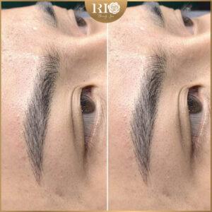 Cập Nhật Chi Tiết Giá Điêu Khắc Chân Mày Hairstroke 2025 9 Điêu khắc lông mày Hairstroke tại ở sở thẩm mỹ uy tín Rio Beauty Clinic
