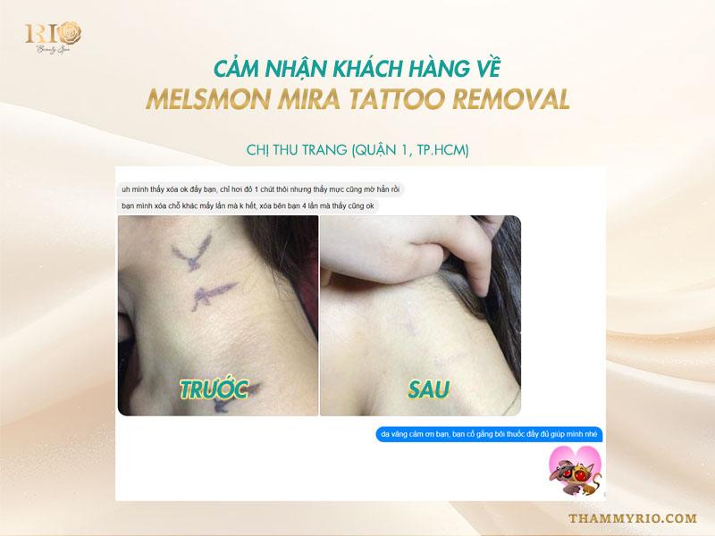 Melsmon Mira Tattoo Remover : Phục hồi da sau xóa xăm laser hoàn hảo 12 Hàng ngàn khách hàng đã tin tưởng và trải nghiệm Melsmon Mira Tattoo Remover sau liệu trình xóa xăm tại Thẩm Mỹ Rio và nhận được những phản hồi vô cùng tích cực.