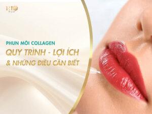 Phun Môi Collagen: Quy Trình, Lợi Ích Và Những Điều Cần Biết