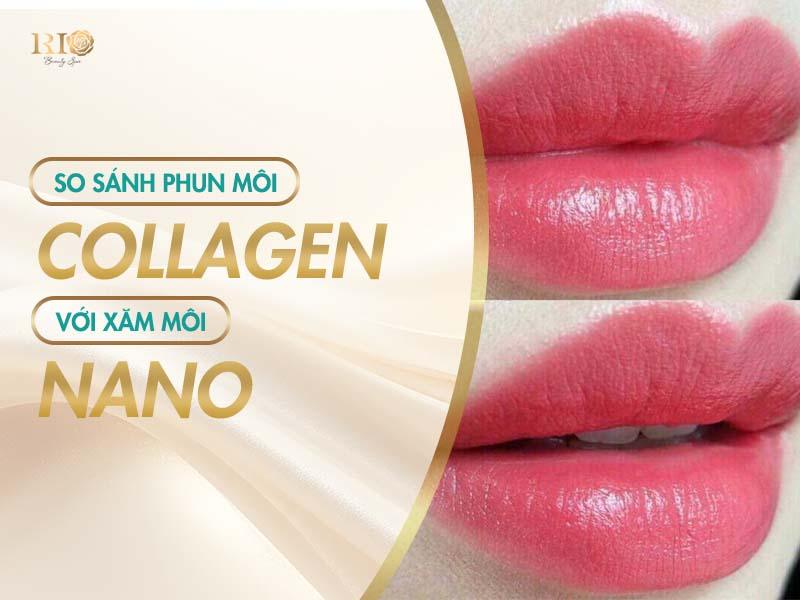 Phun môi collagen: Quy trình, lợi ich và những điều cần biết 3 So sánh phun môi Collagen với các phương pháp làm đẹp khác