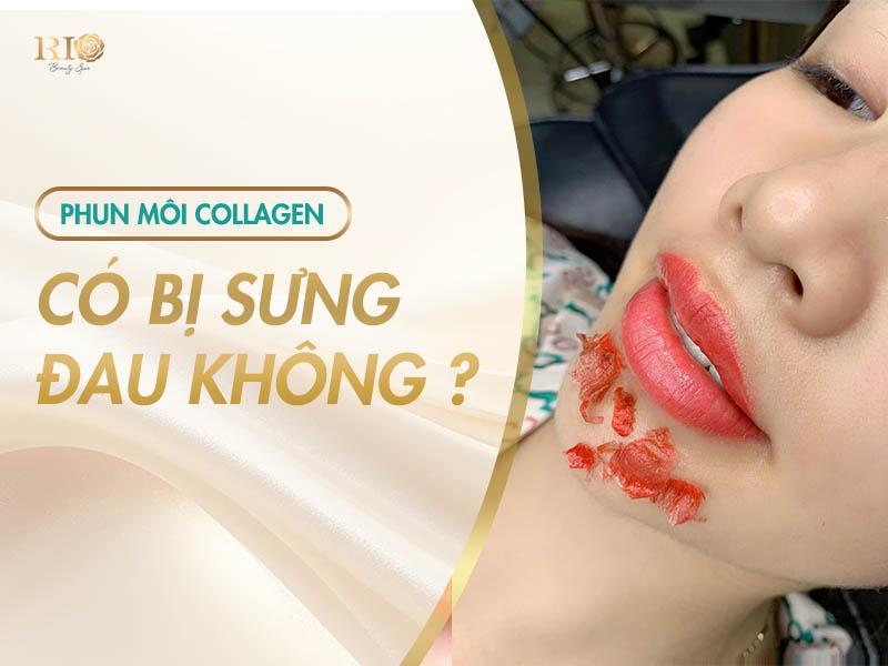 Phun môi collagen: Quy trình, lợi ich và những điều cần biết 7 Phun môi collagen có đau không, sưng không?