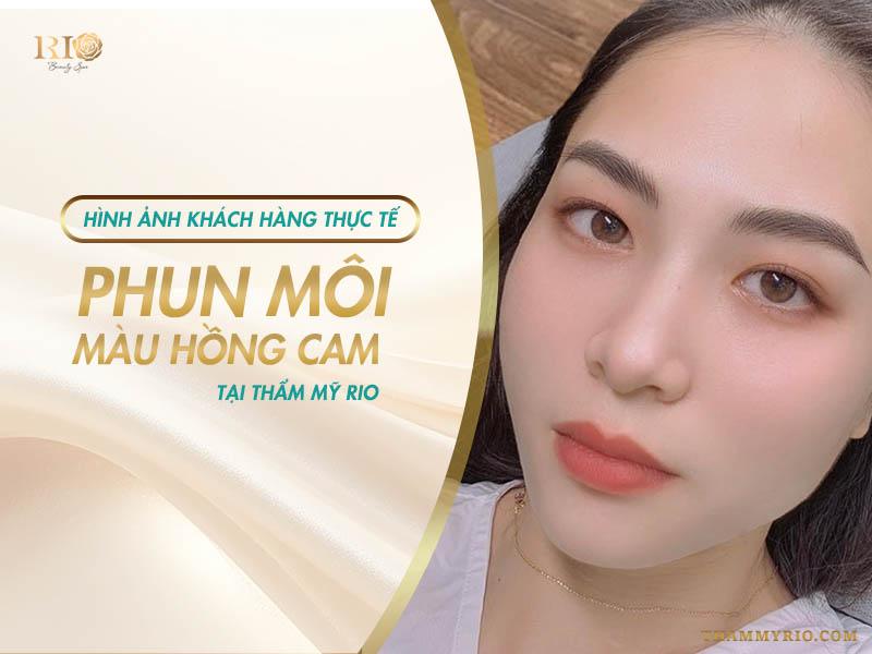 Hình ảnh khách hàng thực tế tại Thẩm Mỹ Rio Beauty