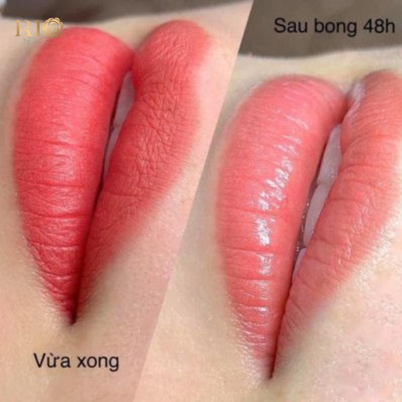 Có nên xăm phun môi màu hồng đào không? Sự khác biệt là gì? 4 Giai đoạn bong da lên màu môi sau 5-7 ngày thực hiện quy trình phun môi.