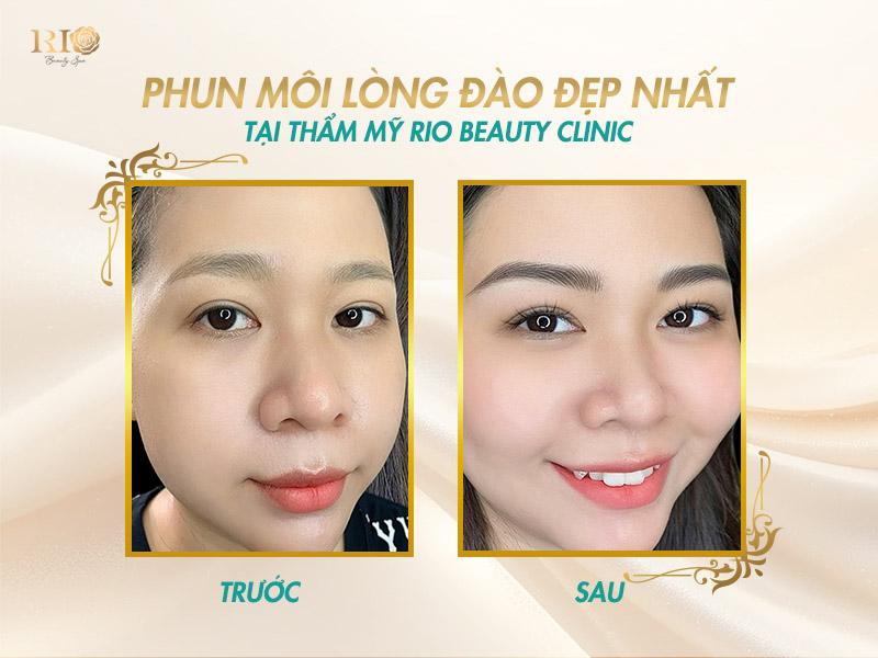 Có nên xăm phun môi màu hồng đào không? Sự khác biệt là gì? 7 phun moi mau hong dao 11 of 16