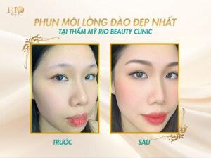 Kết quả phun môi màu hồng đào thành công còn thể hiện ở việc không còn tình trạng thâm hay loang màu