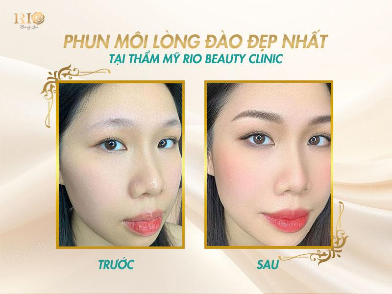 Có nên xăm phun môi màu hồng đào không? Sự khác biệt là gì? 6 Kết quả phun môi màu hồng đào thành công còn thể hiện ở việc không còn tình trạng thâm hay loang màu