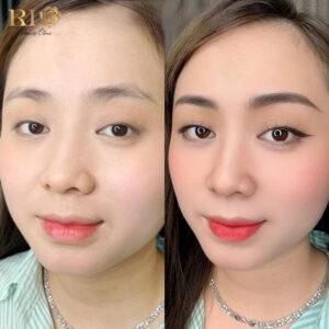 Phun xăm môi TravyLip được sáng tạo độc quyền bởi những Master đoạt giải nhất về phun xăm thẩm mỹ Phạm Thanh Tâm và Nguyễn Thủy Tiên. Với sự kết hợp ngoạn mục từ 2 người đoạt giải quán quân PMU phun xăm thẩm mỹ Việt Nam và Thái Lan