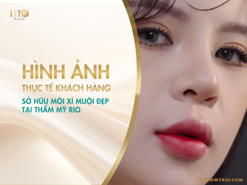 Phun Môi Xí Muội Đẹp Tự Nhiên, Chuẩn Hàn Quốc 2025 3 Khác với phun môi truyền thống, kỹ thuật này tạo hiệu ứng ombre, với màu sắc đậm dần từ lòng môi và nhạt dần về phía viền môi, mang đến đôi môi mềm mại, tự nhiên như chỉ thoa một lớp son nhẹ.