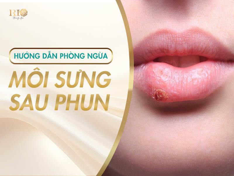 Xăm Môi Bị Sưng Do Đâu, Cách Khắc Phục Và Chăm Sóc Hiệu Quả 8 Hướng dẫn phòng ngừa môi sưng sau phun
