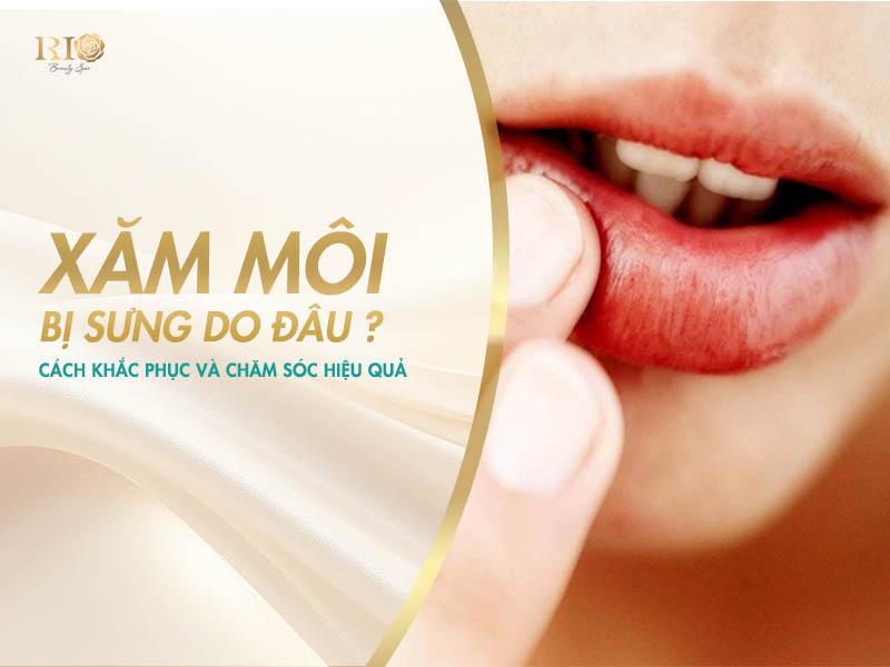 Xăm Môi Bị Sưng Do Đâu, Cách Khắc Phục Và Chăm Sóc Hiệu Quả 3 Xăm môi bị sưng phải làm sao - những cách khắc phục đơn giản, hiệu quả