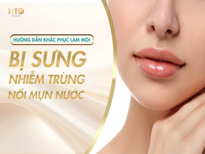 Xăm Môi Bị Sưng Do Đâu, Cách Khắc Phục Và Chăm Sóc Hiệu Quả 4 Hướng dẫn khắc phục tình trạng làm môi bị sưng, nhiễm trùng, nổi mụn nước