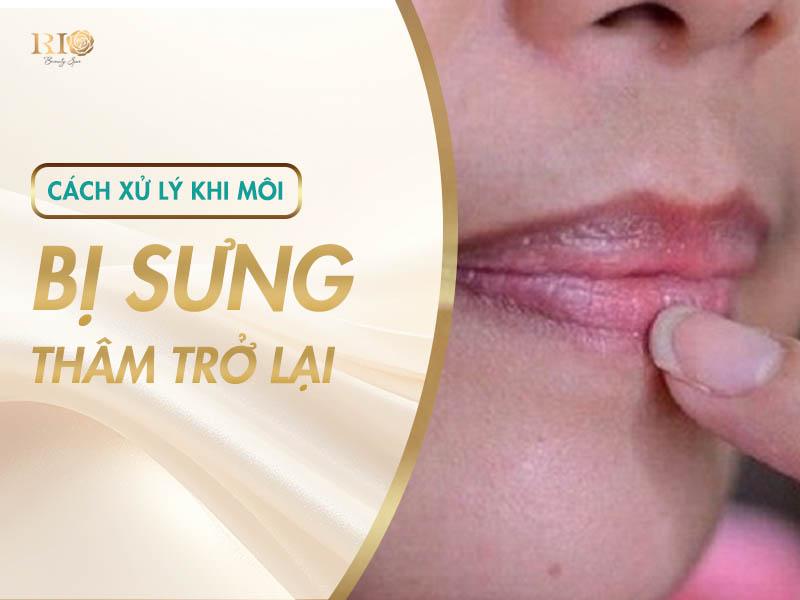 Xăm Môi Bị Sưng Do Đâu, Cách Khắc Phục Và Chăm Sóc Hiệu Quả 7 Cách xử lý khi xăm môi bị sưng, thâm trở lại