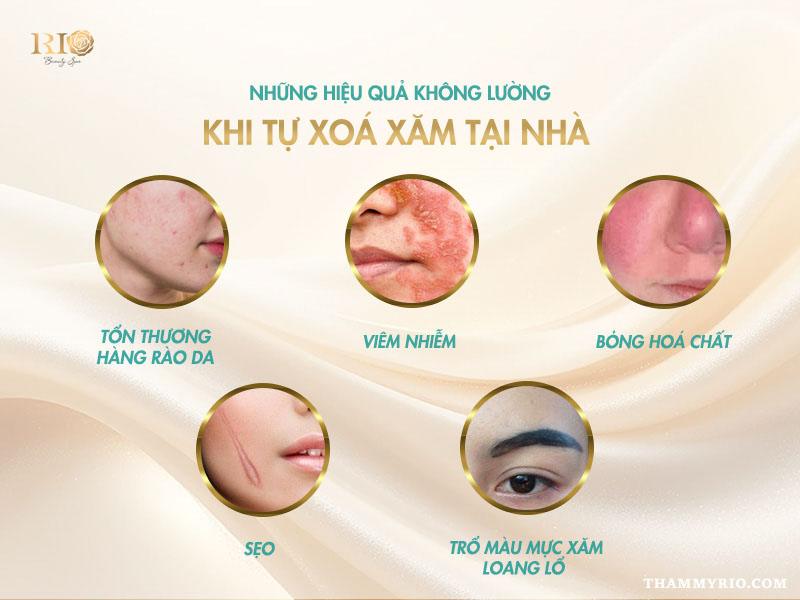 6 cách xóa xăm chân mày tại nhà đơn giản có thể bạn chưa biết 10 Rủi ro khi áp dụng các cách tự xóa xăm chân mày tại nhà