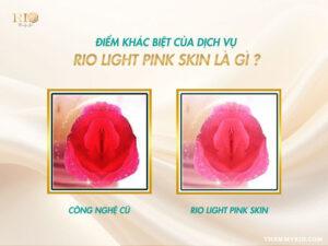 Hãy hình dung Rio Light Pink Skin không phải là một kiểu "xăm" thông thường. Đây là nghệ thuật "tô màu" cho làn da, một kỹ thuật thẩm mỹ siêu tinh tế.