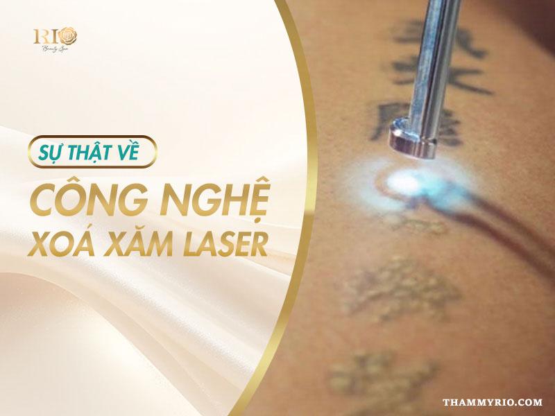 Sự thật về công nghệ xóa xăm laser