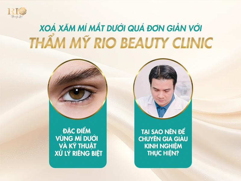 Xóa xăm mí mắt 2025: Công nghệ xóa xăm nào an toàn nhất? 7 Vùng mí mắt dưới là khu vực cực kỳ nhạy cảm và đòi hỏi kỹ thuật cao khi xóa xăm mí. nên cần có các chuyên gia xóa xăm mí mắt đủ tay nghề tránh những biến chứng khi xóa xăm mí mắt