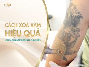 Thẩm Mỹ Rio Beauty Clinic sẽ cùng bạn khám phá chi tiết các phương pháp tẩy xăm hiện nay, phân tích những rủi ro có thể gặp phải và quan trọng hơn, bật mí 5 yếu tố then chốt quyết định đến hiệu quả của quá trình xóa xăm